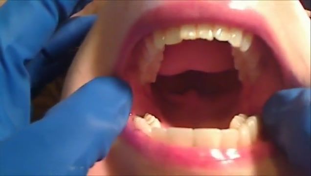 Babe Gloved Mouth Exam Porness